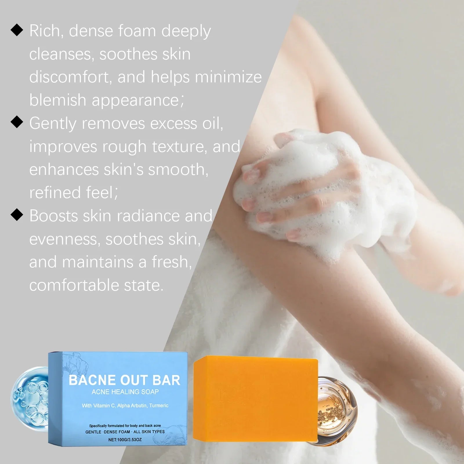 Bacne out Bar Acne Control Soap