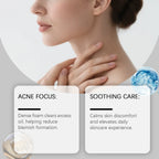 Bacne out Bar Acne Control Soap