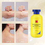 Arenzza deep moisturizing itch relief lotion in a white tube, designed for winter skin hydration and non-greasy comfort.