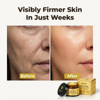 Arenzza anti-aging peptide face cream shown in a split image with before and after skin improvement.