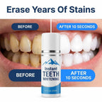 A before and after comparison of BrightSmile™ peroxide-free teeth whitening care from Arenzza, showing improved brightening for sensitive teeth.