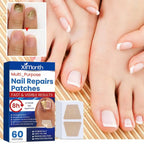 Arenzza HealthyNail™ Fungal Nail Restoration Patches on nails, designed to restore clear, healthy nails discreetly.