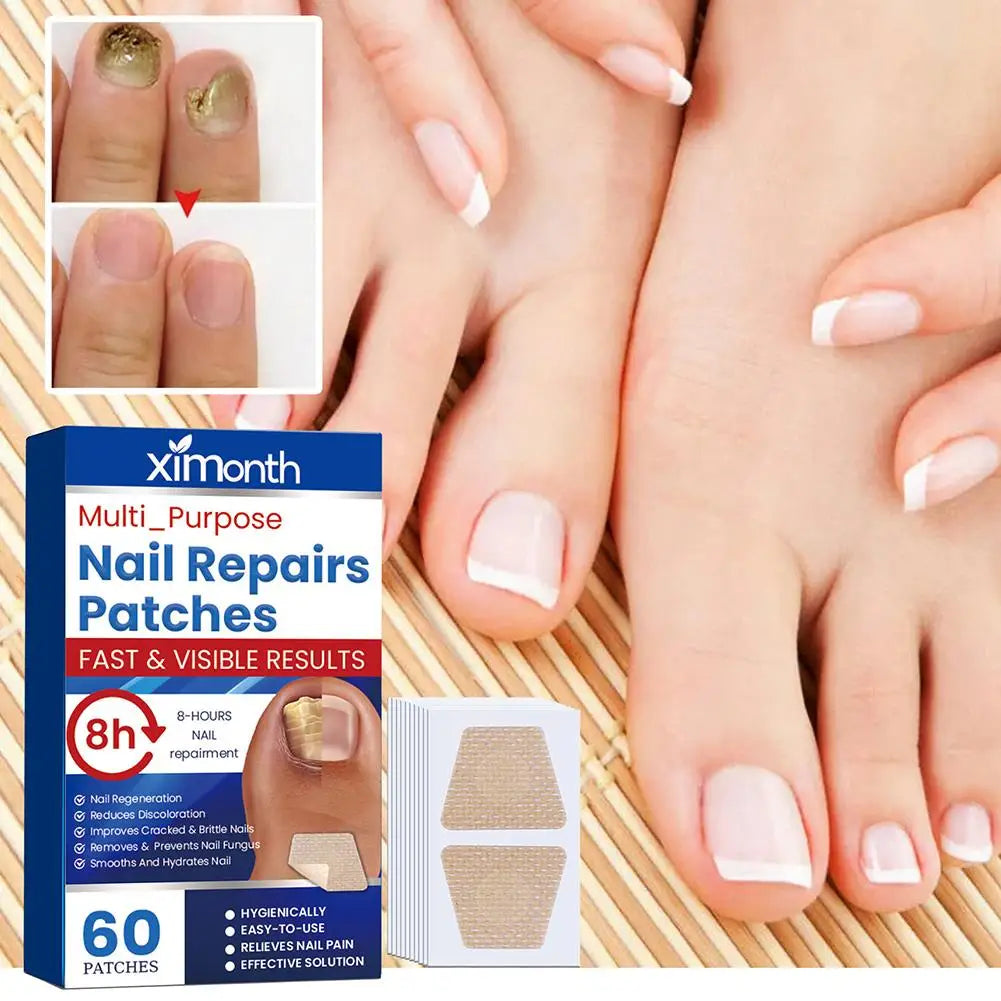 Arenzza HealthyNail™ Fungal Nail Restoration Patches on nails, designed to restore clear, healthy nails discreetly.