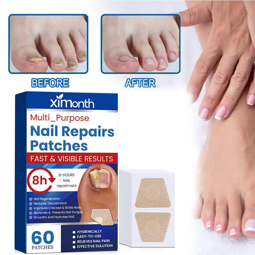 Arenzza HealthyNail™ fungal nail restoration patches applied to toenails, restoring clear, healthy nails discreetly.