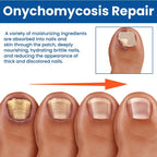 HealthyNail™ Fungal Nail Restoration Patches by Arenzza, discreet clear patches for restoring healthy, clear nails.