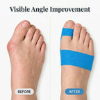 Arenzza Quietstep™ elastic bunion relief wrap shown in a split image with before and after fit on a foot.