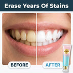 SmileBright™ Arenzza instant whitening and enamel care kit showing before and after smile improvement in split image.