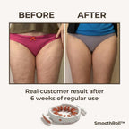 Arenzza SmoothRoll™ 360 Degree Cellulite Reducer with textured rolling surface for effective skin toning and cellulite reduction.