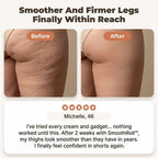 A woman using the Arenzza SmoothRoll™ 360-degree cellulite reducer device on her thigh for skin smoothing and cellulite reduction.