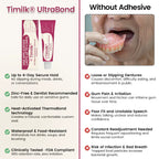 A close-up of Timilk® UltraBond Premium Denture Adhesive tube by Arenzza with applicator tip against a plain background