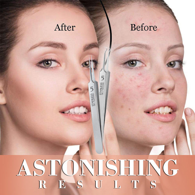 Arenzza beauty salon tweezers for precise hair removal in health and beauty, featuring stainless steel tips for salon use.