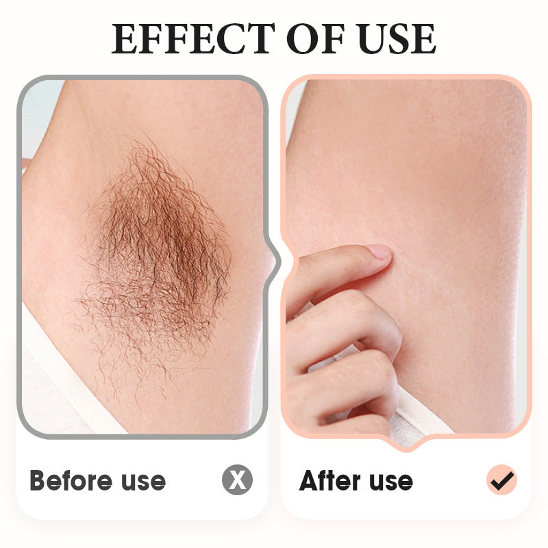 Arenzza gentle hair removal cream for underarms, legs, and arms, in a white tube with a blue cap, on a white background.