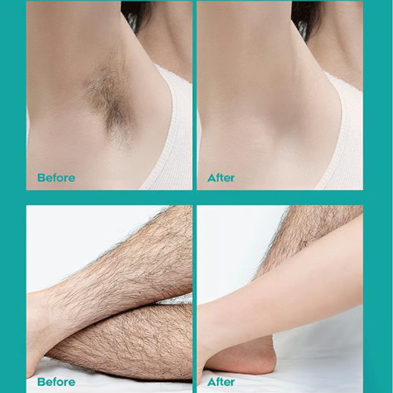 Arenzza painless full body hair removal cream for men and women, skin-friendly formula shown in a sleek container.