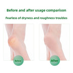 Arenzza antibacterial foot wash with 360° brush for cleaning stinky feet, shown in a clear health and beauty product image.