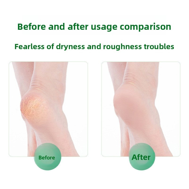 Arenzza antibacterial foot wash with 360° brush for cleaning stinky feet, shown in a clear health and beauty product image.