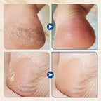 Arenzza hydrating foot cream in a white jar, designed to moisturize and prevent cracking for healthy, soft feet.