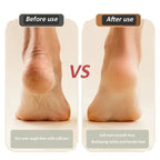 Arenzza digital electric foot polisher for health and beauty, showing a sleek device with a textured roller for foot care.