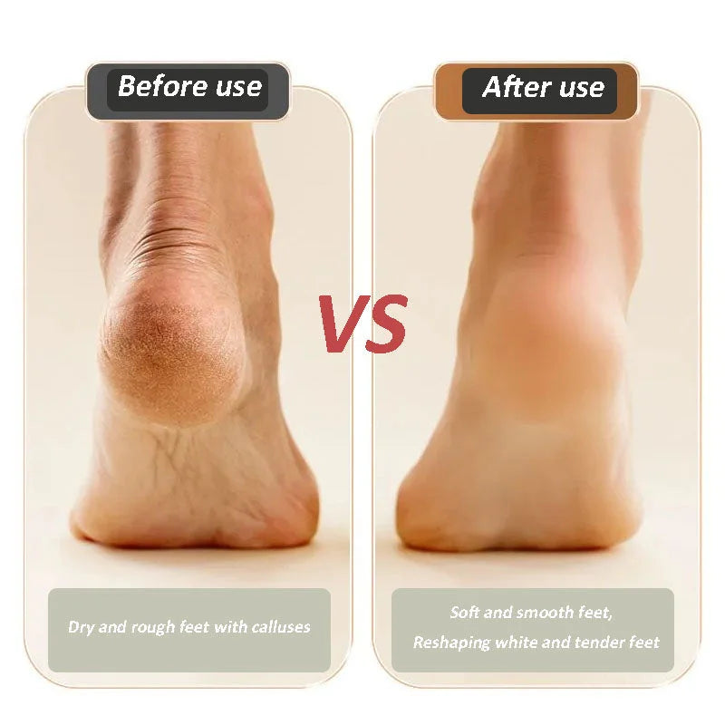 Arenzza digital electric foot polisher for health and beauty, showing a sleek device with a textured roller for foot care.