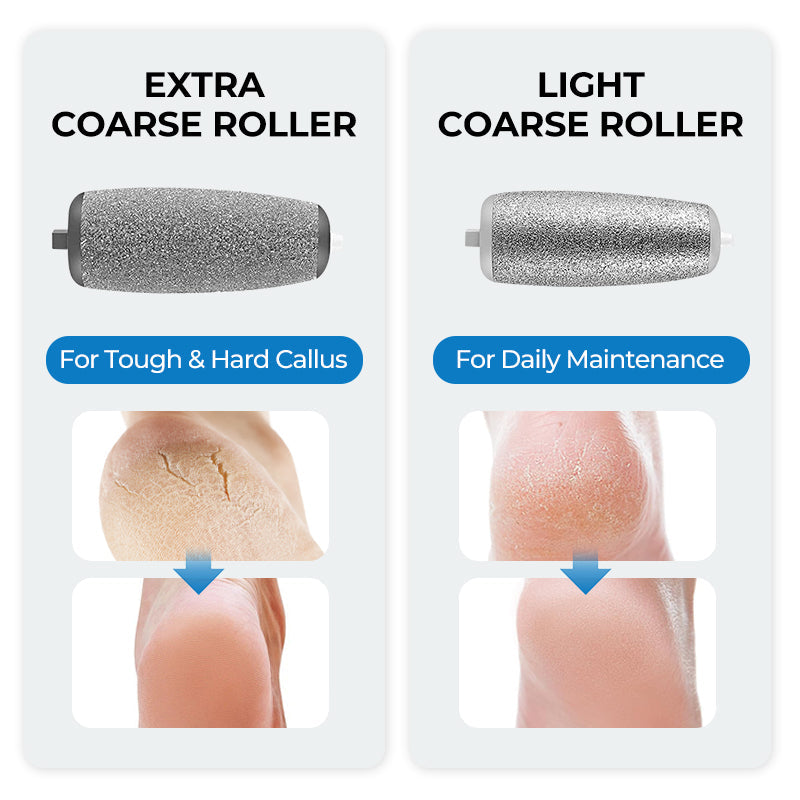 Arenzza electric feet callus remover in use, showing its compact design and exfoliating head for smooth, healthy feet.