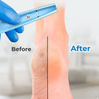Arenzza electric feet callus remover in use, showing the device removing rough skin from the heel for smooth, healthy feet.