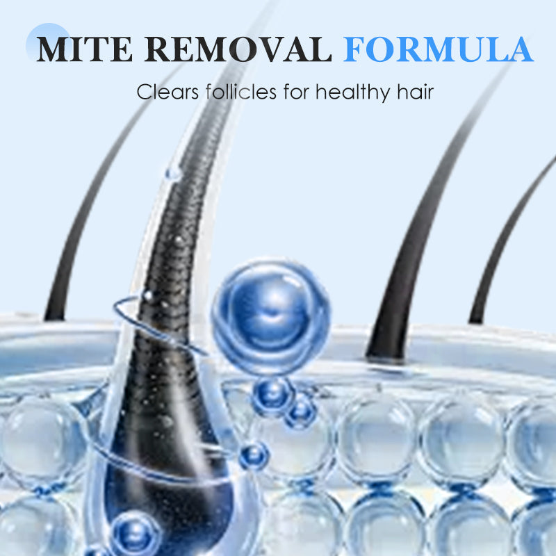 Arenzza Oil-Control & Anti-Dandruff Shampoo bottle for healthy scalp and dandruff relief, displayed on a clean background.