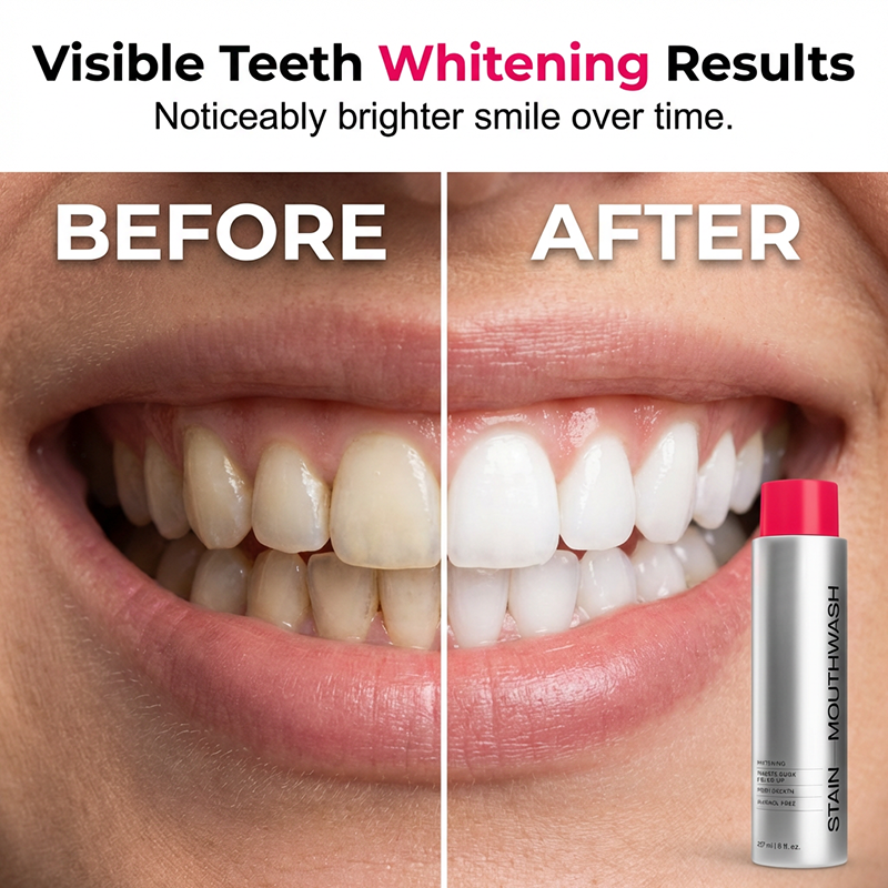 Arenzza stain-removing whitening mouthwash bottle, showing mint leaves and fresh teeth, designed for daily use to fight stains.