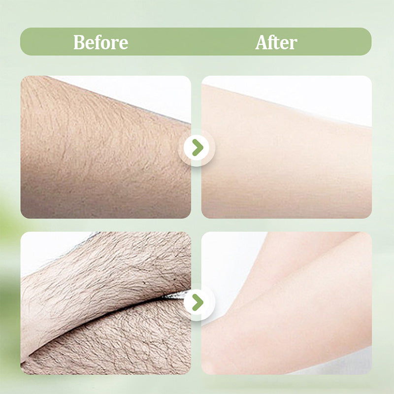 Arenzza gentle hair removal cream tube, non-irritating formula for smooth skin, displayed on a clean white background.