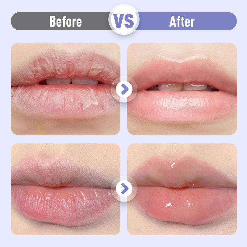 Arenzza plumping and anti-wrinkle hydrating lip serum in a sleek tube with a wand applicator, designed to enhance lip fullness and hydration.