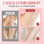 Arenzza portable dual-head electric epilator for hair removal, shown with sleek design and dual attachments for smooth skin.