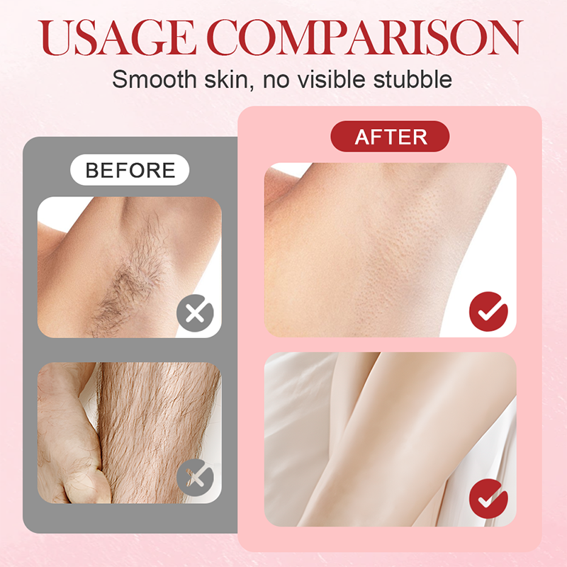 Arenzza portable dual-head electric epilator for hair removal, shown with sleek design and dual attachments for smooth skin.