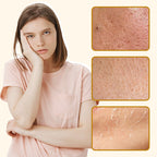 Arenzza organic beef tallow balm with honey, moisturizing cream for skin hydration and nourishment in a jar.