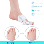 Arenzza bunion corrector for men and women, designed to realign toes and reduce bunion discomfort in a health and beauty setting.
