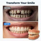 A set of custom fit Arenzza dentures with adhesive-free design, shown in a before and after comparison highlighting comfort and fit.