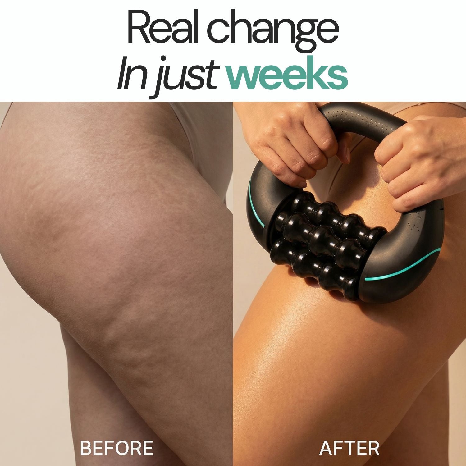Arenzza Neurothlet Rollshaper in summer-ready leg design, showcasing sleek, stretchy compression fabric for comfortable support.
