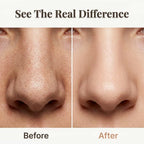 A before and after split image of the Arenzza SonicClean™ ultrasonic skin cleanser showing improved skin clarity and smoothness.