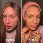 Aurenza Shop pink deep collagen gel mask shown in a before and after comparison, highlighting facial skin improvement.
