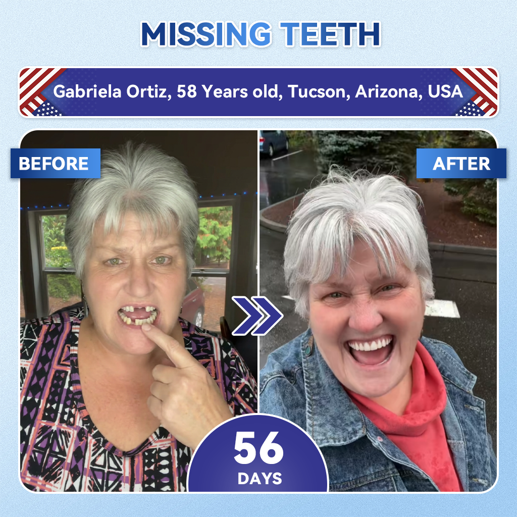 WIMAID® Fast-Dissolving Oral Strips by Aurenza Shop for advanced daily oral care, shown dissolving on a person's tongue.