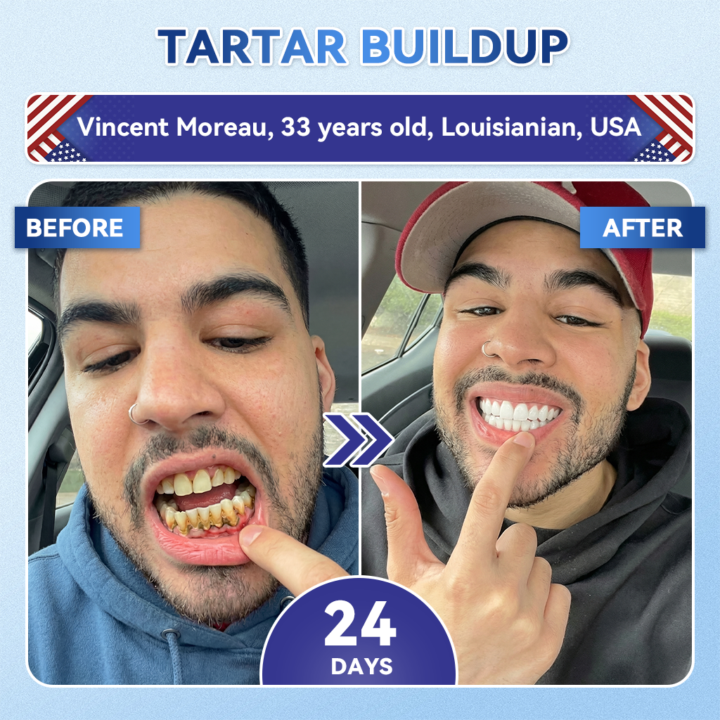 Aurenza Shop WIMAID® Fast-Dissolving Oral Strips for advanced daily oral care, showing the strips in a clear blister pack.