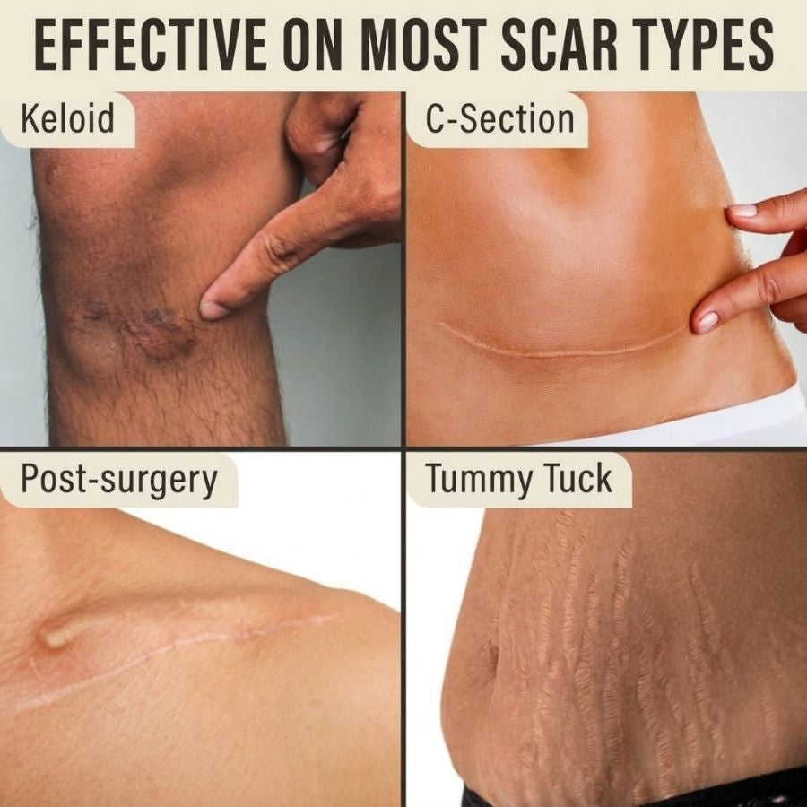 DermaShield™ Pro Scar Matrix by Aurenza Shop showing a close-up of the advanced scar treatment device with medical-grade materials.