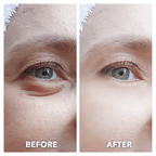 Aurenza LumiLift™ Eye Perfector showing before and after images highlighting skin firming and brightening effects.
