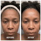 Aurenza LumaShape™ 3-in-1 Sculptor device with sleek design, showing multiple angles and features for body contouring and shaping.