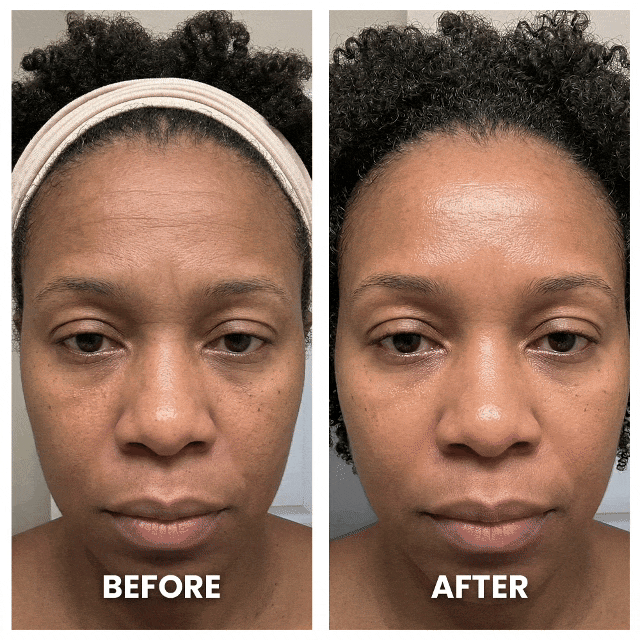 Aurenza LumaShape™ 3-in-1 Sculptor device with sleek design, showing multiple angles and features for body contouring and shaping.