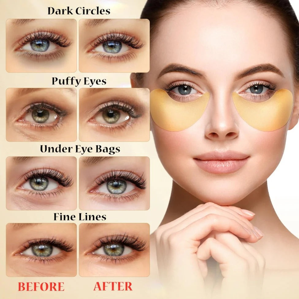 Aureza Haven gold under eye patches on a woman’s under-eye area, moisturizing and revitalizing skin with a luxurious gold formula.