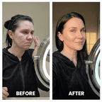 Aurenza ProSculpt™ Neck and Face Lifter device showing a close-up of the sleek, ergonomic design for skin tightening.