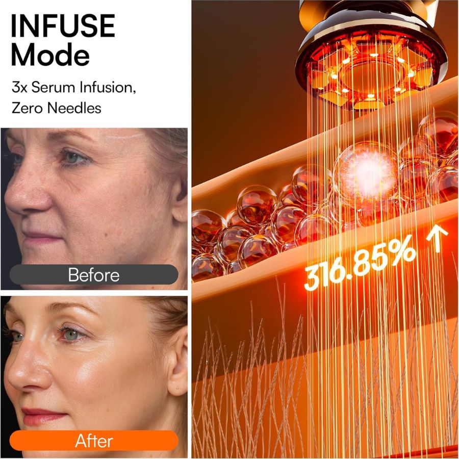 A close-up of the Dermalea ProSculpt™ Neck & Face Lifter demonstrating its sleek design for skin tightening and lifting.