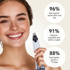 Aurenza blackhead remover pore vacuum cleaner with a sleek black design, demonstrating its use on facial skin to clear pores.