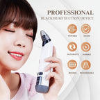 Aurenza Shop blackhead remover pore vacuum cleaner with a sleek black design and a cleaning nozzle on a white background.