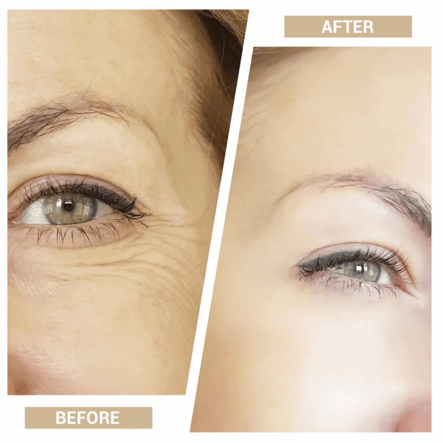 Aurenza 3-in-1 mini facial toning and rejuvenation device showing before and after skin improvement images.
