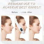 Aurenza Smart Face Sculpting Device with 8 modes for double chin reduction and jawline definition, shown in use.
