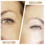 Aurenza 7-in-1 facial toning and rejuvenation galvanic sculptor device showing before and after skin improvement images.